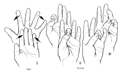 Post Hand Surgery Information Sheet : Rebecca Ayers